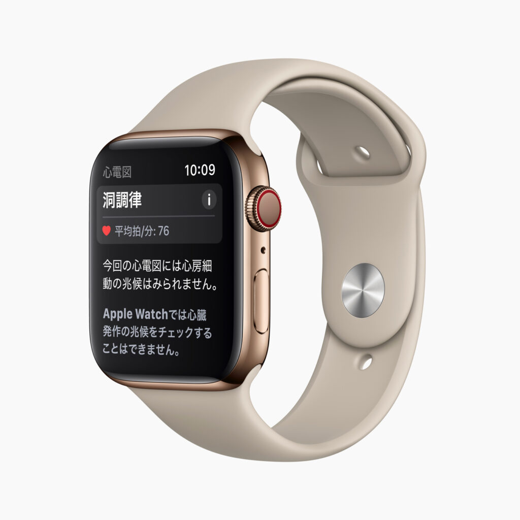 Apple Watch 心電図